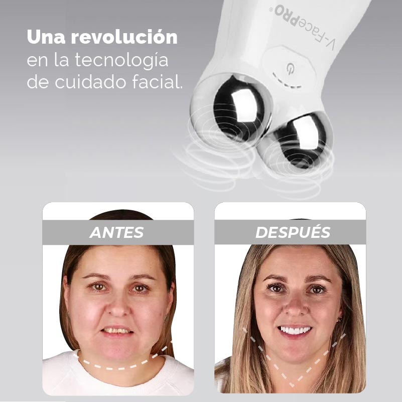 TONIFICADOR FACIAL MAGNÉTICO V-FACEPRO® | ⭐⭐⭐⭐⭐